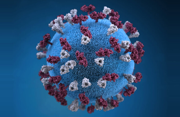 Measles virus.